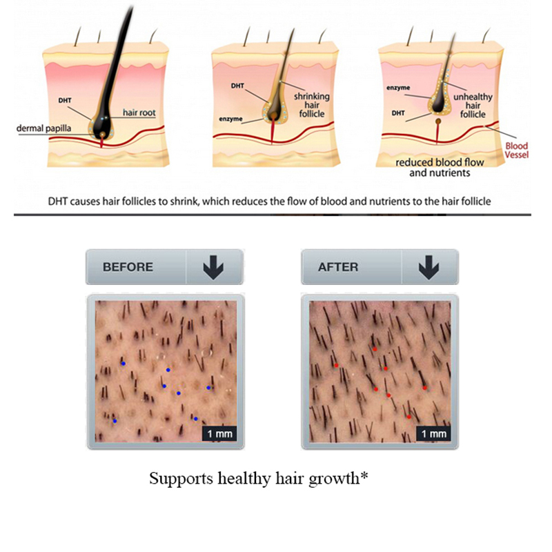 PURC 100ml Shampoo per la perd - Licorice Root Sticks recensione e prezzo